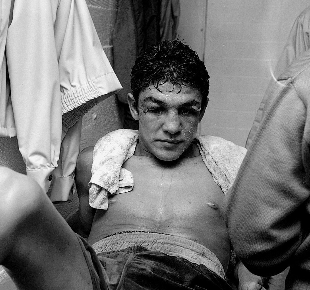 Mando in his dressing room after the fight. 
