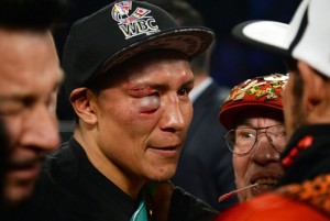 The price of glory: Vargas was fortunate the bout was not stopped.